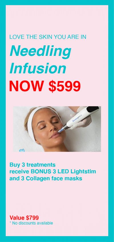 needling-infusion-special